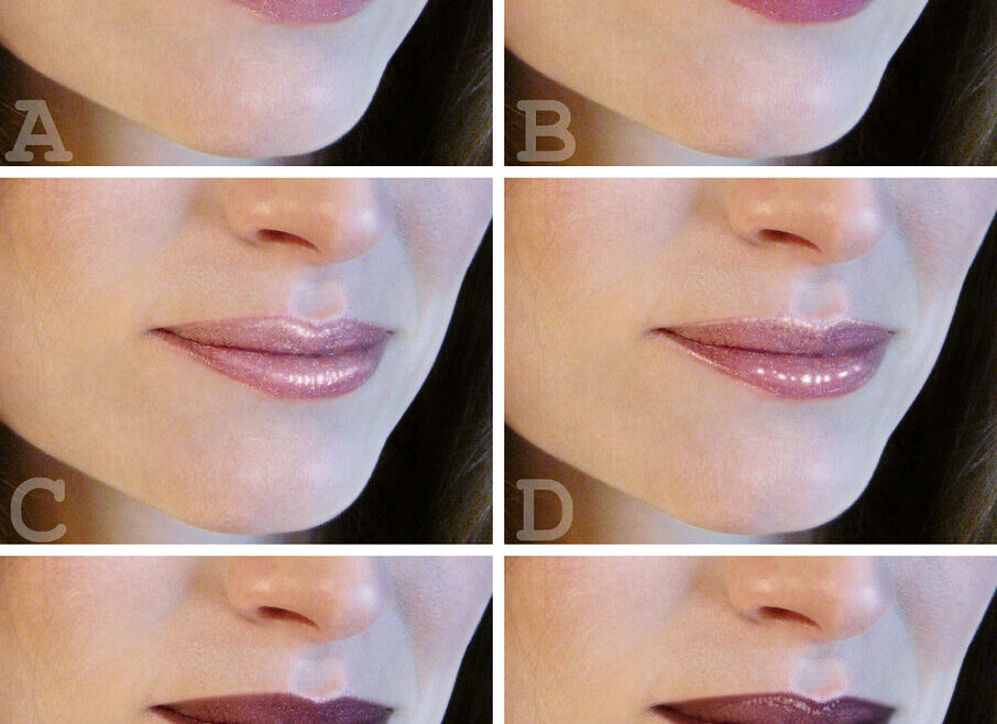 lip fillers on small mouth